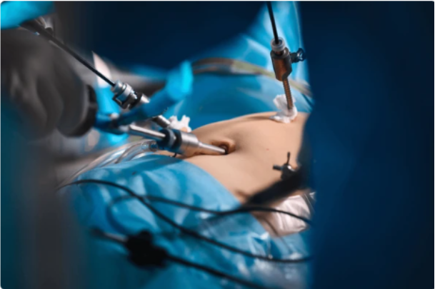 Best Gastro Surgeon in Bangalore