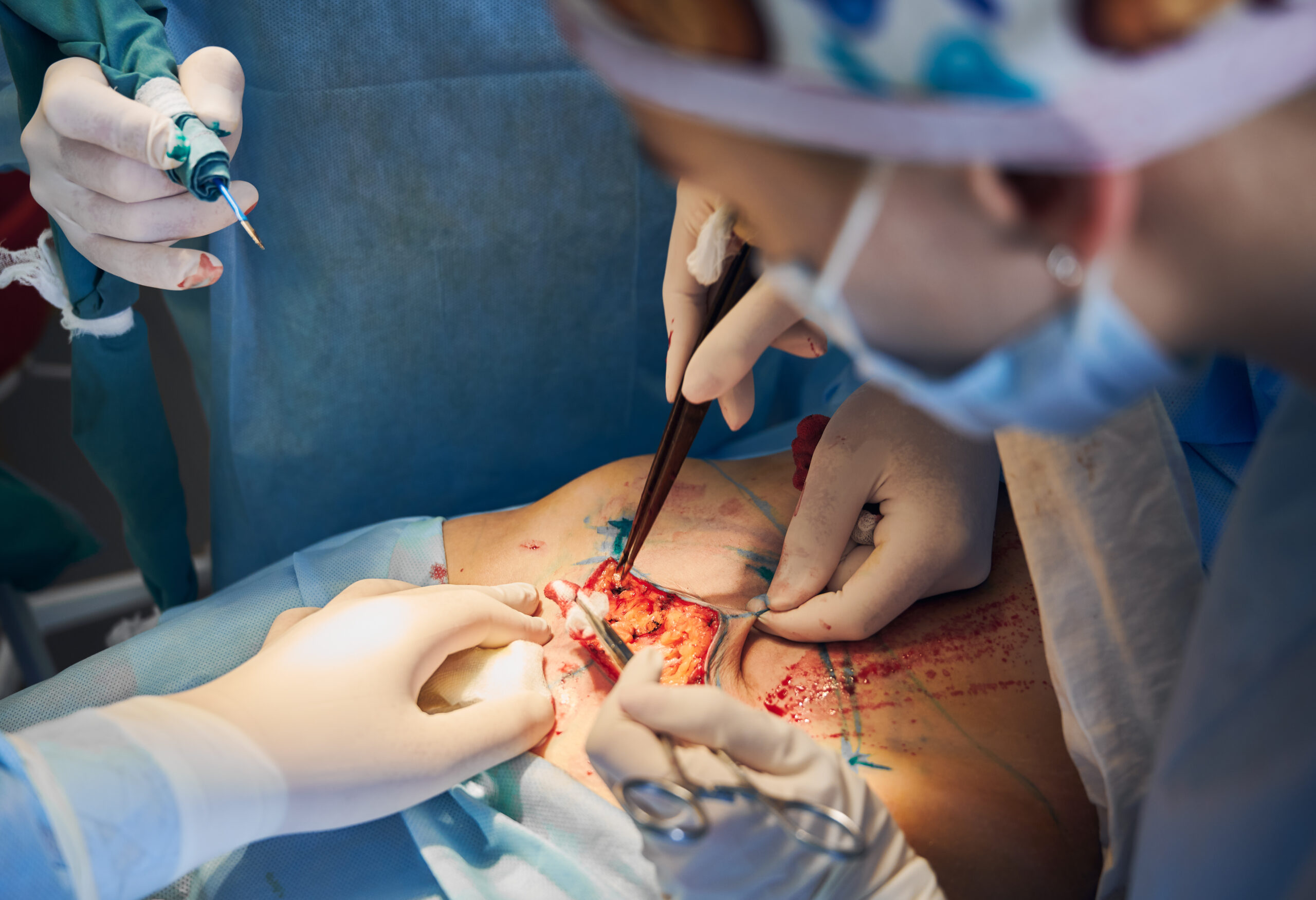 Gastrointestinal surgeon in Yeswanthpur