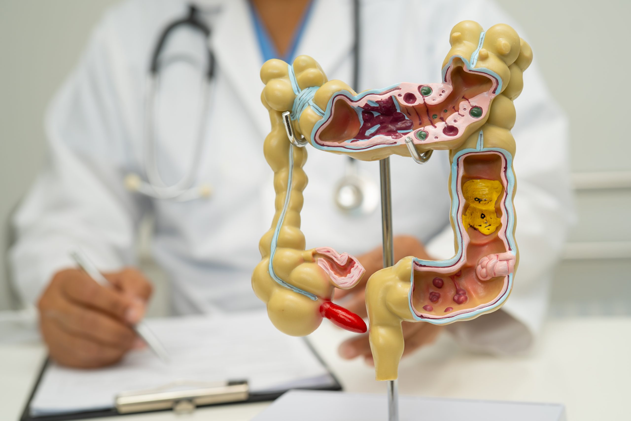 Colorectal Cancer Surgery in Yeshwanthpur