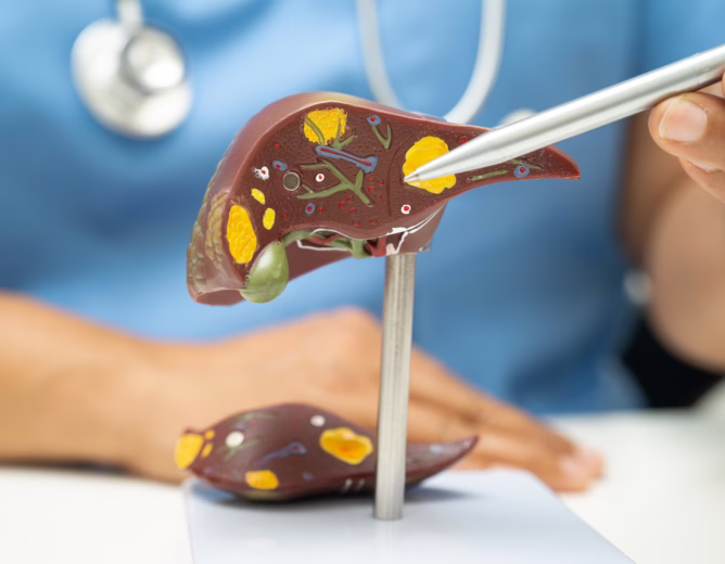 Gallbladder Stones: Symptoms, Causes, Treatment & When Surgery Is Needed