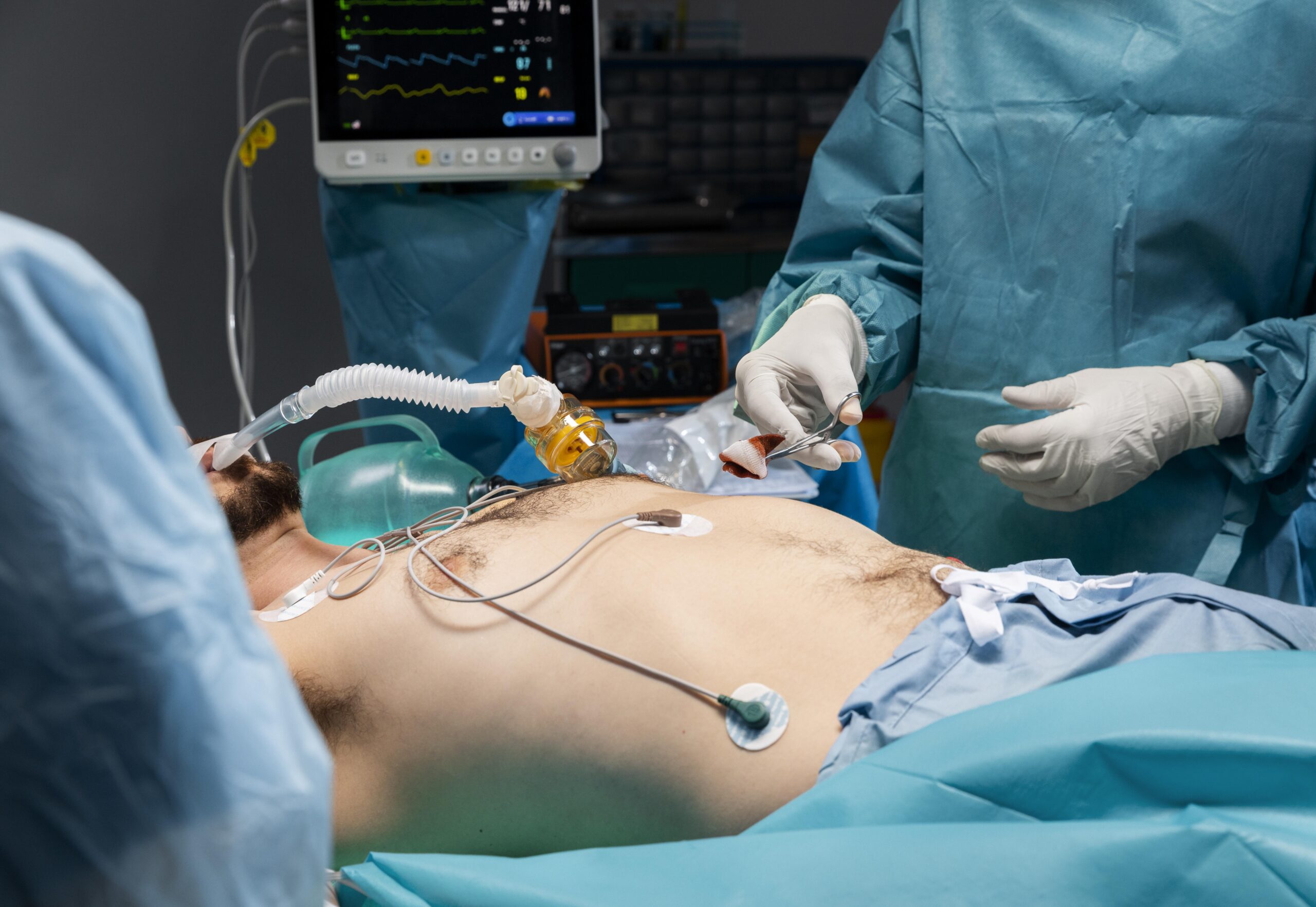 Laparoscopic GI Onco Surgery Bangalore