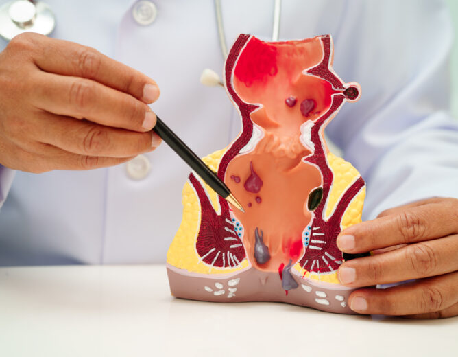 Why Anal Fissures Keep Coming Back Even After Treatment: Understanding the Root Cause