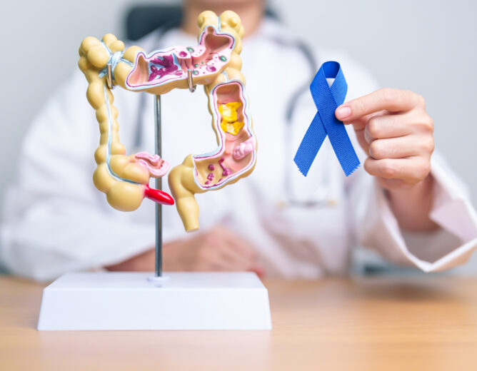 How a GI Onco Surgeon Detects Gastrointestinal Cancer Early