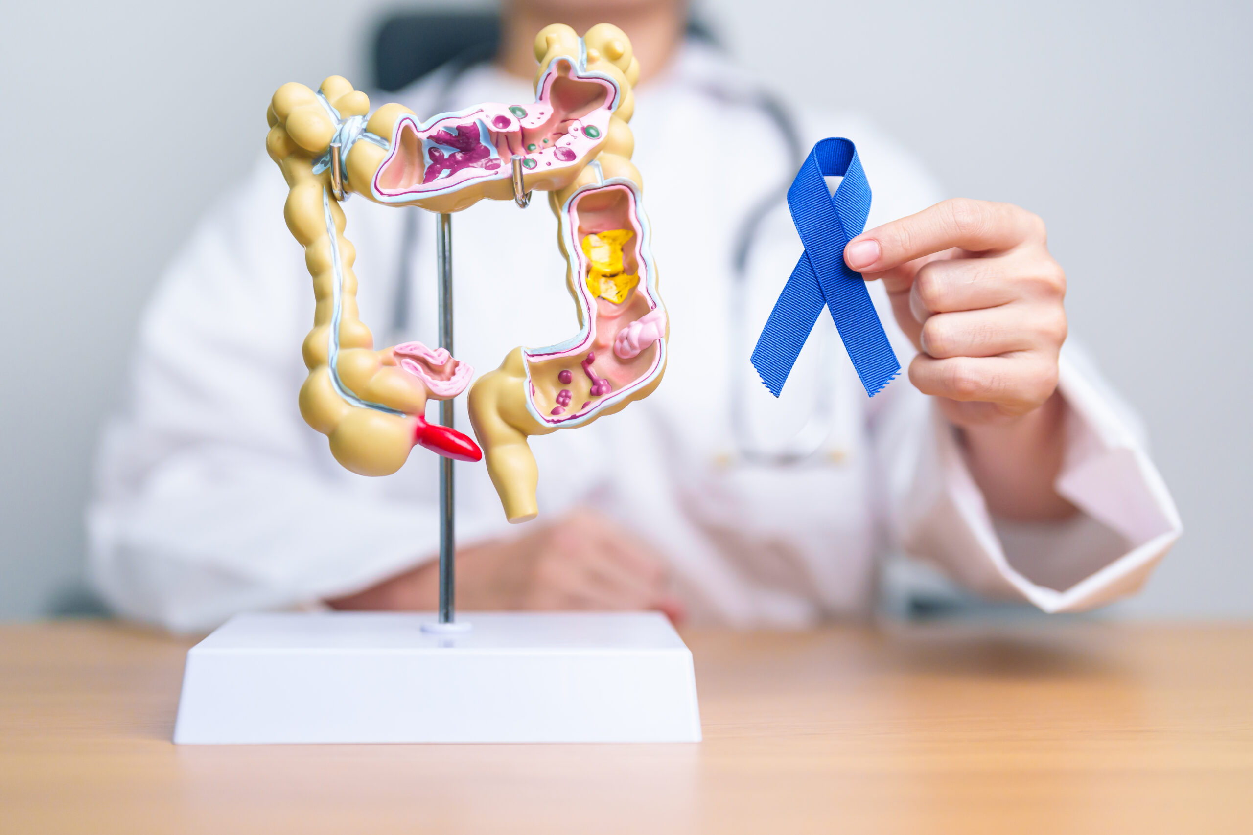 GI Onco Surgery in Bangalore